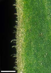 Veronica rivalis. Leaf margin showing hairs. Scale = 1 mm.
 Image: W.M. Malcolm © Te Papa CC-BY-NC 3.0 NZ